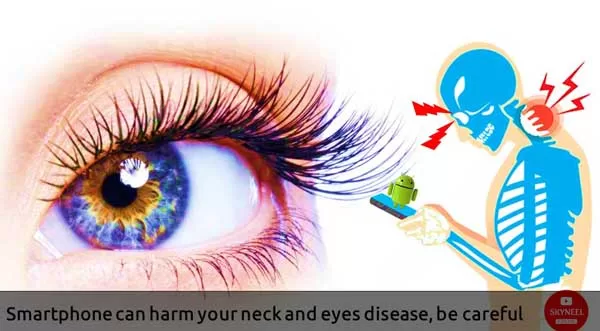 Smartphone can harm your neck and eyes disease, be careful Smartphone can harm your neck and eyes disease, be careful